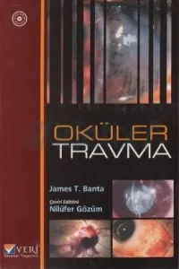 Oküler Travma