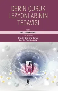 Derin Çürük Lezyonlarının Tedavisi