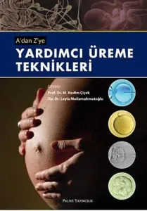 Adan Zye Yardımcı Üreme Teknikleri