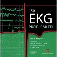 150 Soruda EKG Problemleri