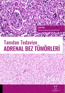 Tanıdan Tedaviye Adrenal Bez Tümörleri