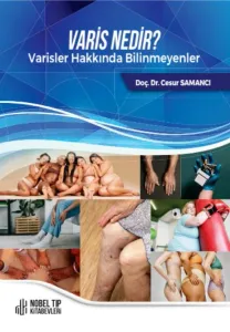 Varis Nedir ?
