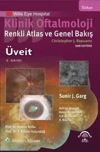 Klinik Oftalmoloji Renkli Atlas ve Genel Bakış - ÜVEİT