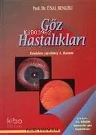 Göz Hastalıkları