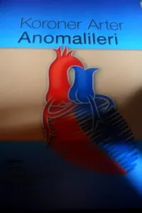 Koroner Arter Anomalileri