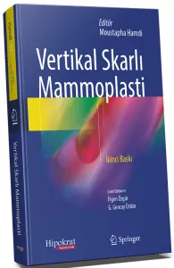 Vertikal Skarlı Mammoplasti