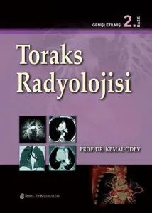 Toraks Radyolojisi - Kemal Ödev