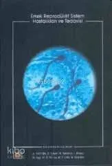 Erkek Reprodüktif Sistem Hastalıkları ve Tedavisi