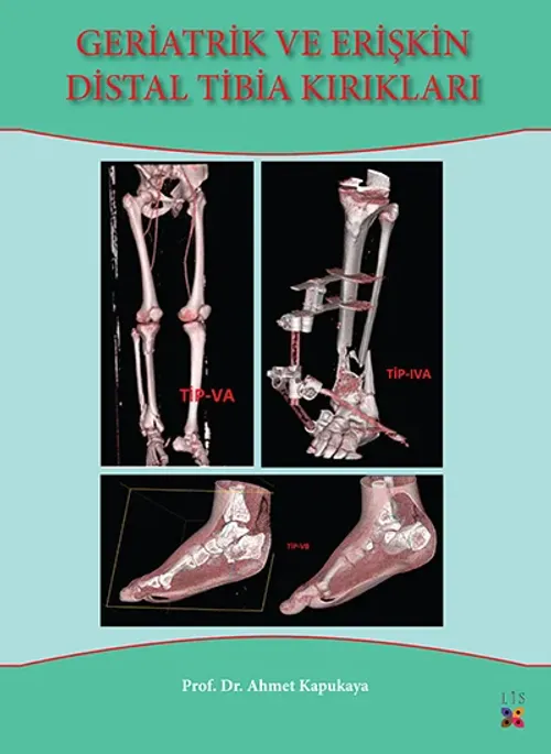 GERİATRİK VE ERİŞKİN DİSTAL TİBİA KIRIKLARI