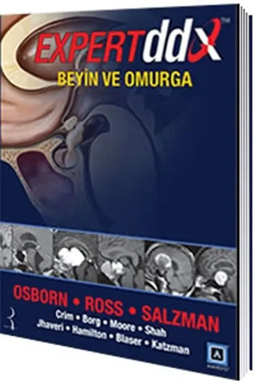 Expert DDX Beyin ve Omurga
