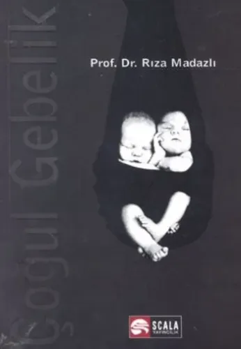 Çoğul Gebelik