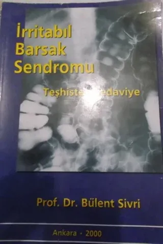 İrritabıl Barsak Sendromu