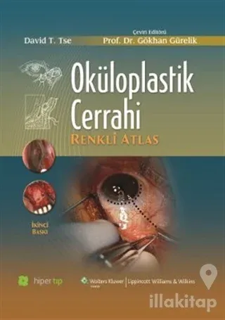 Oküloplastik Cerrahi (Ciltli)
