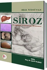 Siroz