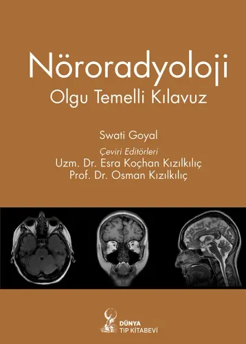 Nöroradyoloji