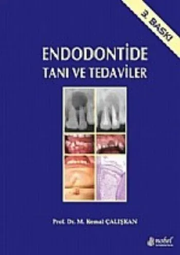 Endodontide Tanı ve Tedaviler (Ciltli)