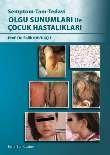Olgu Sunumları ile Çocuk Hastalıkları