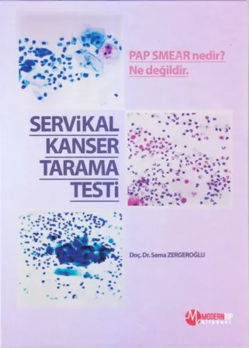 Servikal Kanser Tarama Testi