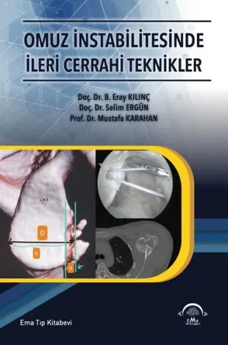 Omuz İntabilitesinde İleri Cerrahi Teknikler