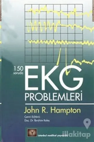150 Soruda EKG Problemleri