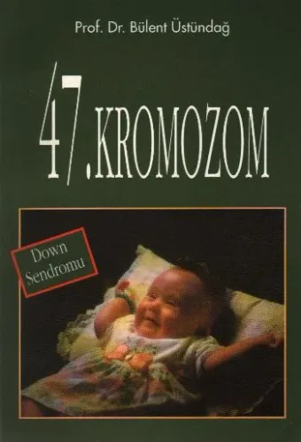 47. Kromozon (Down Sendromu) (Brd)