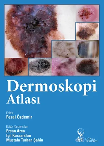 Dermoskopi Atlası