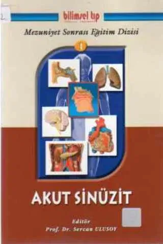 Akut Sinüzit
