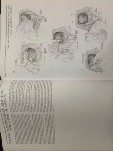 Zollinger's Atlas Of Surgical Operations Robert M.Zollinger McGraw-Hil