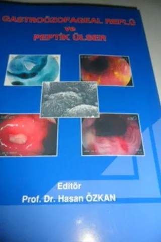 Gastroözofageal Reflü ve Peptik Ülser