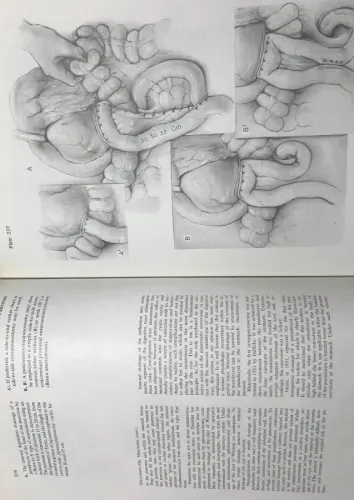 Atlas Of Technics in Surgery Volume 1-2 Cilt John L.Madden's Appleton 