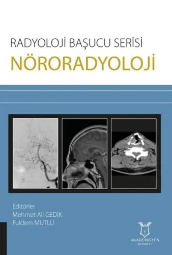 Nöroradyoloji