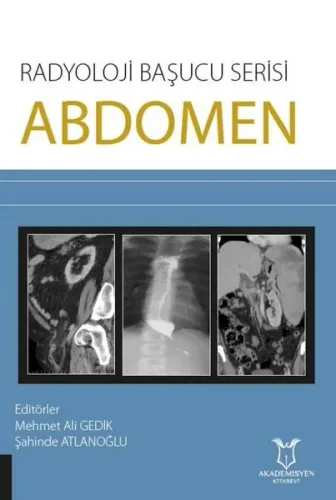 Abdomen