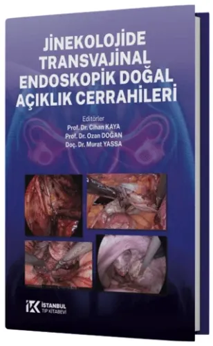 Jinekolojide Transvajinal Endoskopik Doğal Açıklık Cerrahileri