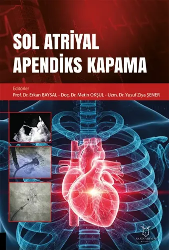 Sol Atriyal Apendiks Kapama
