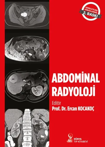 Abdominal Radyoloji