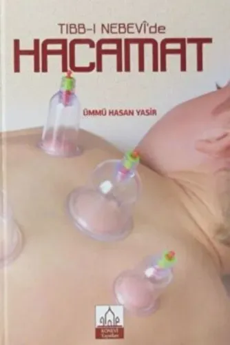 Tıbb-ı Nebevi'de Hacamat