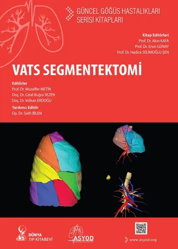 VATS Segmentektomi