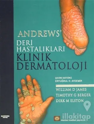 Andrews' Deri Hastalıkları Klinik Dermatoloji (Ciltli)