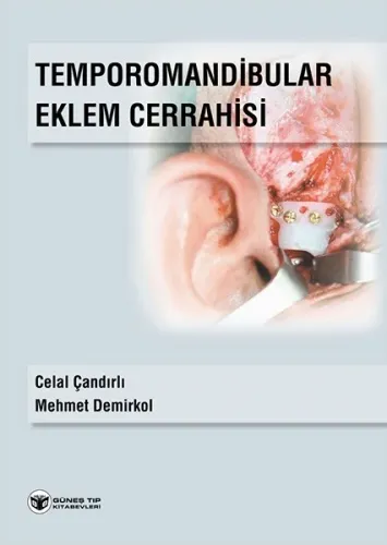 Güneş Tıp Temporomandibular Eklem Cerrahisi