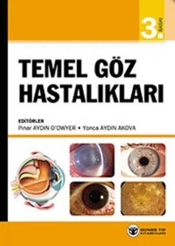 Temel Göz Hastalıkları