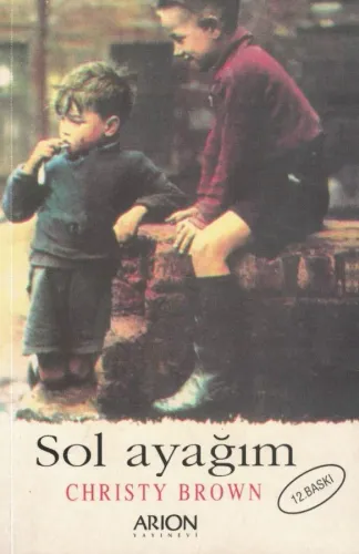 Sol Ayağım
