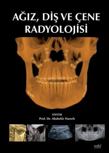 Ağız Diş ve Çene Radyolojisi