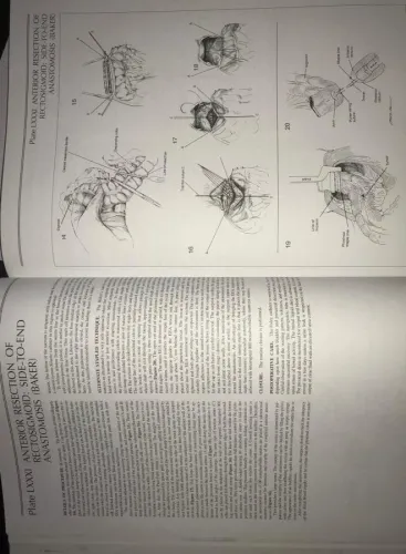 Zollinger's Atlas Of Surgical Operations Robert M.Zollinger McGraw-Hil