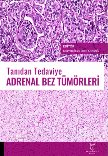 Tanıdan Tedaviye Adrenal Bez Tümörleri
