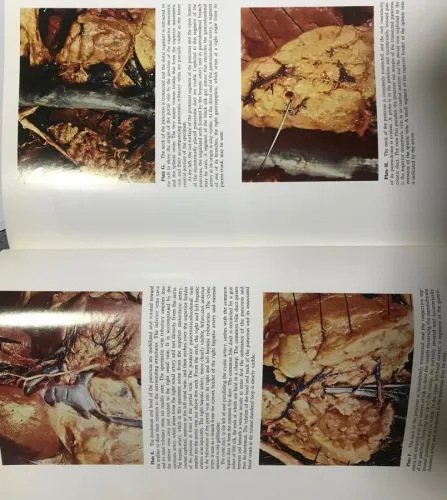 Atlas Of Technics in Surgery Volume 1-2 Cilt John L.Madden's Appleton 