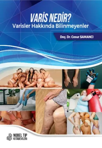 Varis Nedir ?