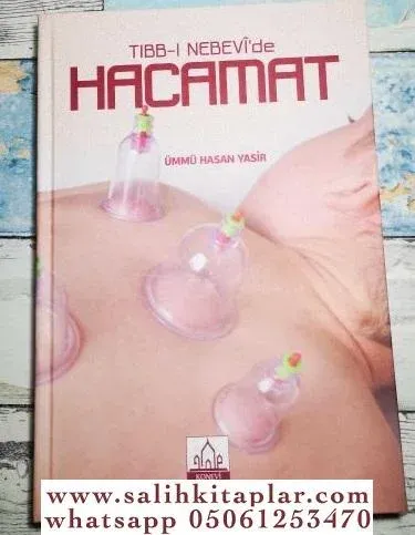 Tıbbı Nebevi'de Hacamat