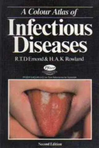 Infectious Diseases