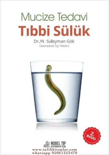 Mucize Tedavi Tıbbi Sülük