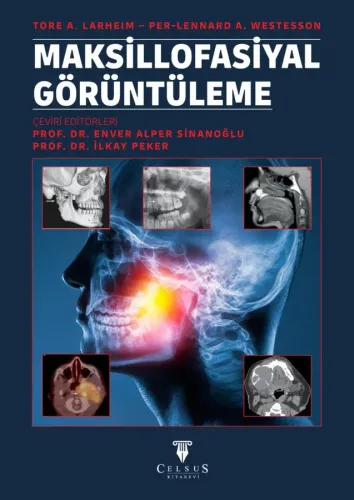 Maksillofasiyal Görüntüleme Tore A. Larheim